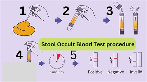Hem Occult Test: Understanding Its Process and Benefits in Colorectal Cancer Screening
